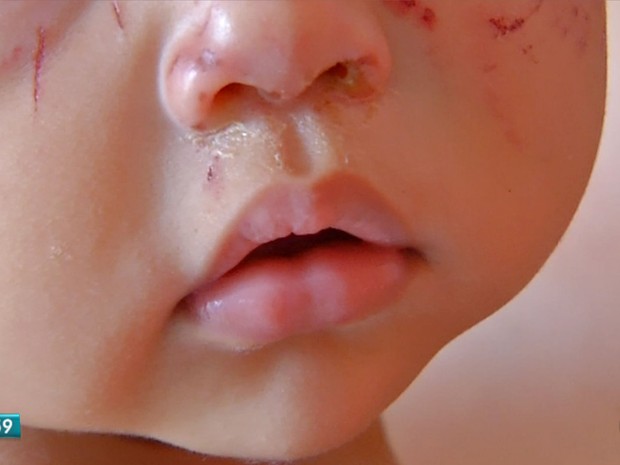 Bebê de 11 meses é agredida em creche particular