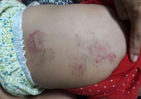 Bebê de 11 meses é agredida em creche particular