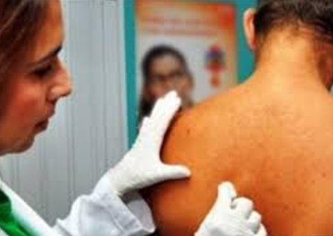 Mutirão oferece consultas dermatológicas gratuitas neste sábado em Manaus