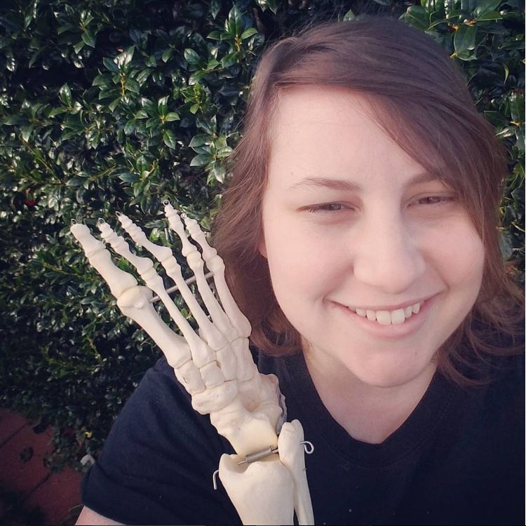 Jovem tem que amputar o pé mas ninguém pode imaginar o que ela fez com o esqueleto depois