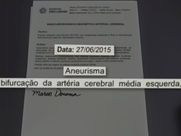 Defesa de Cunha apresenta laudo que atesta aneurisma
