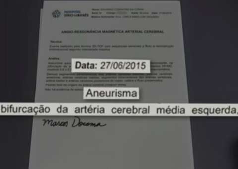 Defesa de Cunha apresenta laudo que atesta aneurisma