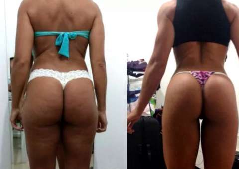 Mãe de 3 vira musa fitness e antes e depois impressiona: 'Eram horas chorando em frente ao espelho'
