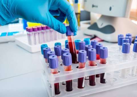 Laboratórios do Hapvida ganham classificação de qualidade