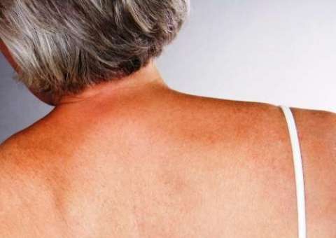 Aliada do rejuvenescimento, planta pode aliviar sintomas da menopausa 