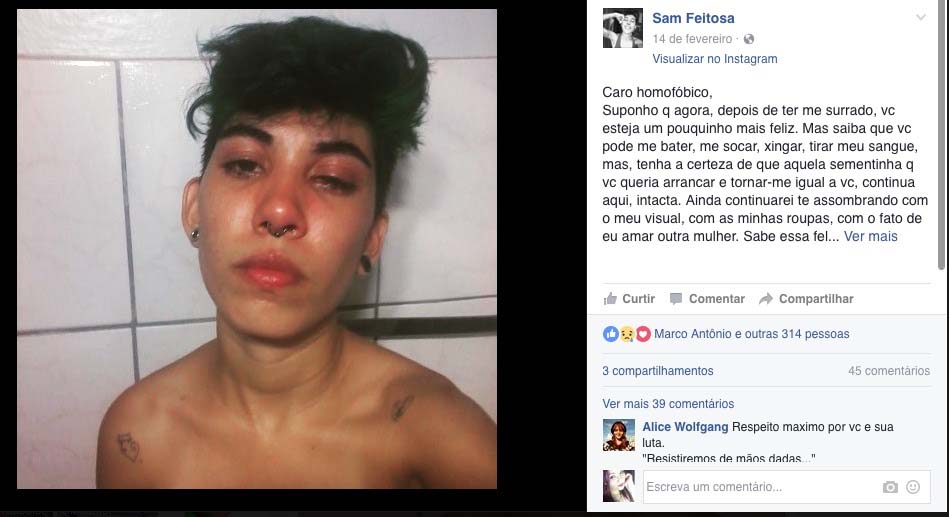 Amazonense é agredida no Rio de Janeiro por dupla de machões homofóbicos 