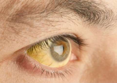 Sobe para 89 número de mortes confirmadas por febre amarela