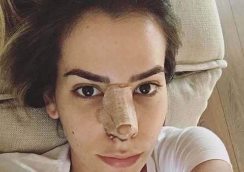  Adriana Sant'Anna faz segunda plástica no nariz e mostra foto pós-cirurgia