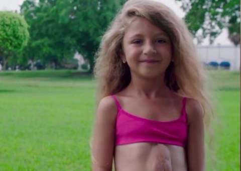 Criança de 7 anos surpreende a todos por ter coração fora da caixa torácica