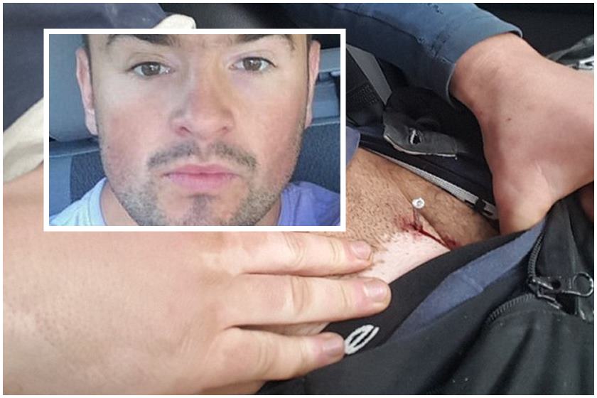 Homem é atingido por um prego na virilha após acidente de trabalho 