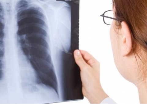 Com ação anti-inflamatória, planta é indicada para combater infecções pulmonares   