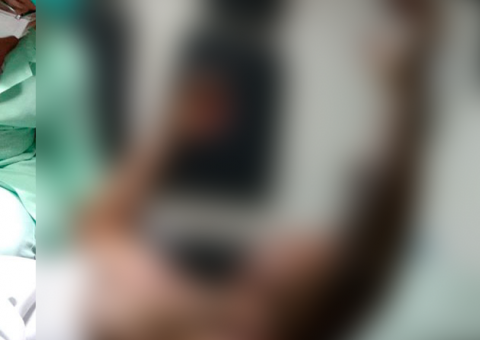 Esposa ateia fogo em companheiro após ser agredida com socos no AM