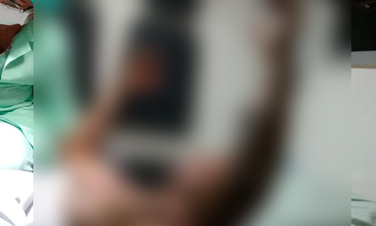 Esposa ateia fogo em companheiro após ser agredida com socos no AM