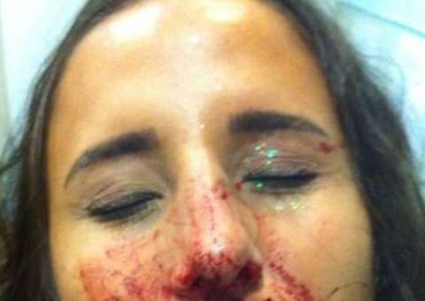 Após ser assediada, mulher é agredida com dois socos em bloco carnavalesco