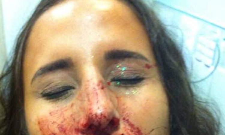 Após ser assediada, mulher é agredida com dois socos em bloco carnavalesco