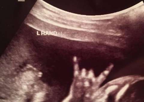 Feto faz suposto sinal de 'mão-chifrada' em ultrassom e pais se surpreendem