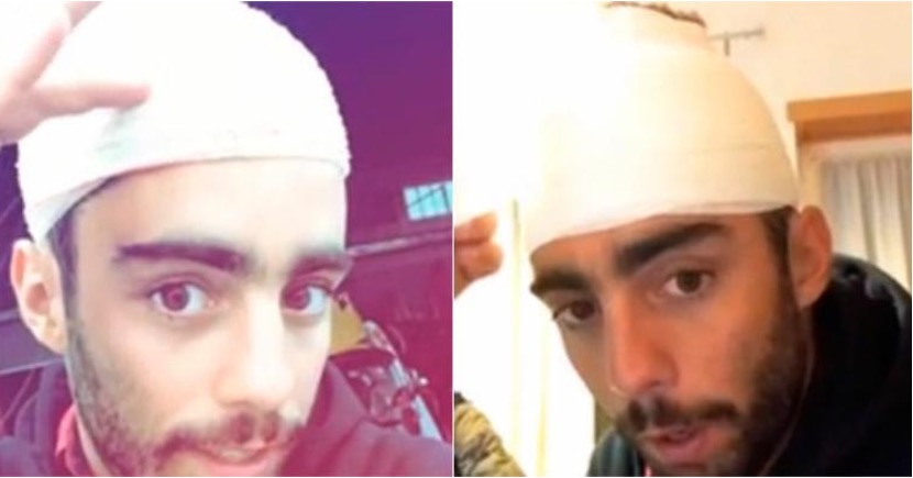 Marido de Luana Piovani quebra a cabeça em acidente