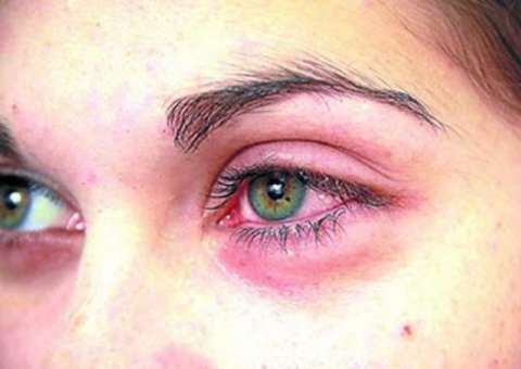 8 Doenças que você pode pegar por compartilhar maquiagem