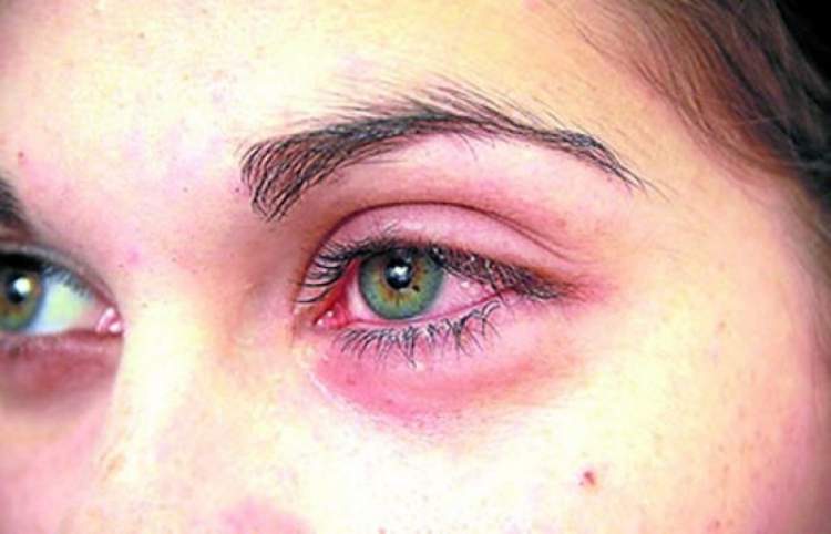 8 Doenças que você pode pegar por compartilhar maquiagem