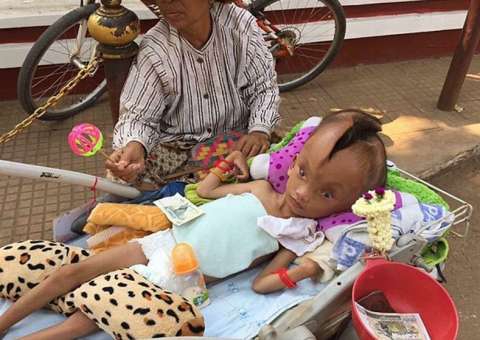 Criança surpreende médicos com rachadura surreal na cabeça