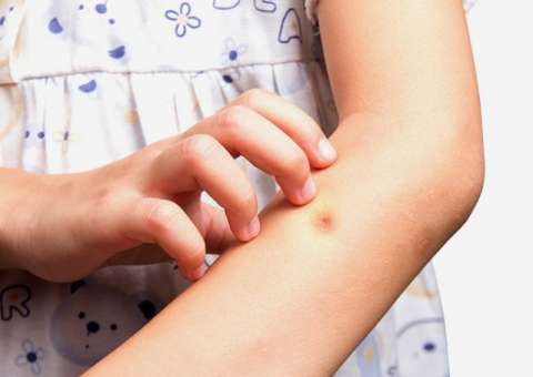 Casca de árvore é indicada para combater infecções causadas por picadas de inseto 