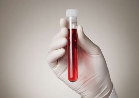 Folha e raiz de planta são indicadas para purificação do sangue 