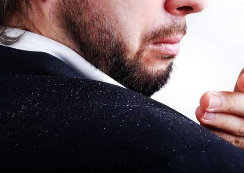 Coberta de pelos picantes, planta pode ser usada para combater caspa