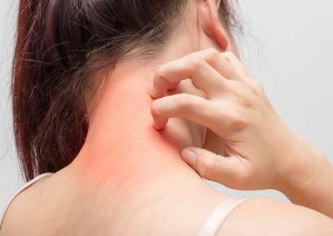 Feita de planta medicinal, pomada ajuda a eliminar eczemas e fungos 