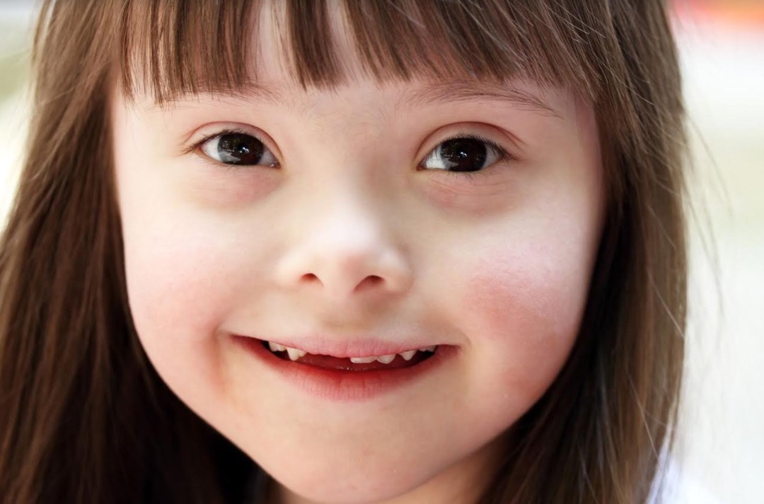 Dia Internacional da Síndrome de Down