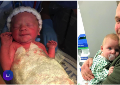 Bebê nasce com intestinos do lado de fora do corpo e é salva por plástico filme