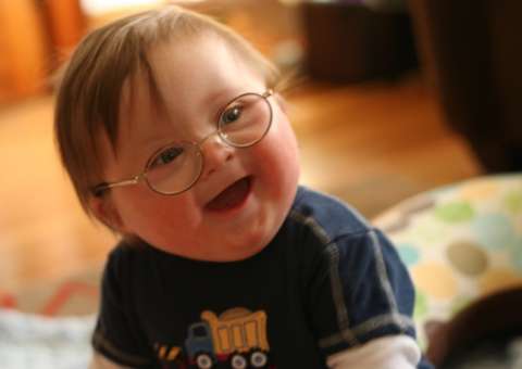 Síndrome de Down: carinho é o melhor remédio