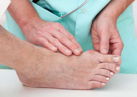 Em Manaus, equipes de saúde são capacitadas para avaliação neuromotora do pé diabético