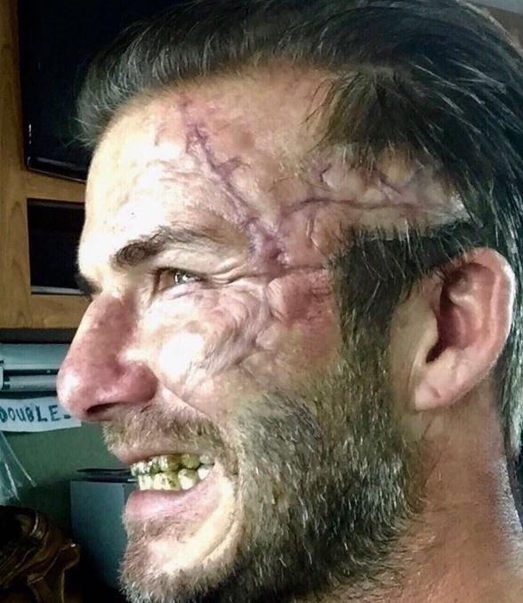 David Beckham assusta fãs ao aparecer com rosto desfigurado nas redes sociais