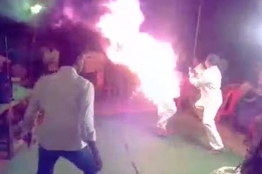 Homem ateia fogo em si mesmo por não aguentar mais ouvir esposa 