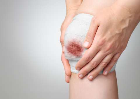 Planta ornamental apresenta propriedade indicada para tratar feridas 