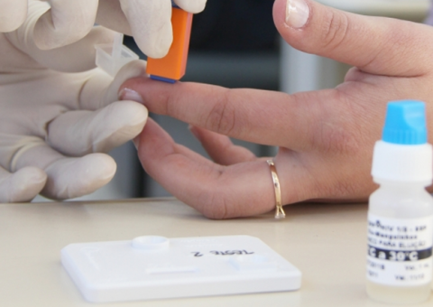 Mais de 400 testes rápidos de HIV são realizados durante campanha em Manaus