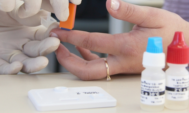 Mais de 400 testes rápidos de HIV são realizados durante campanha em Manaus