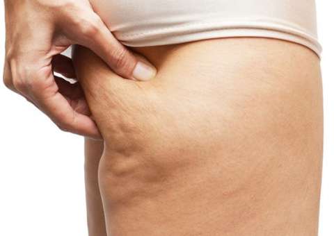 Com propriedades medicinais, planta ajuda a combater celulites