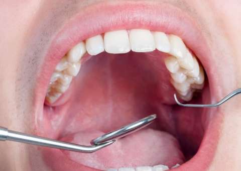 45% das doenças cardíacas começam na boca