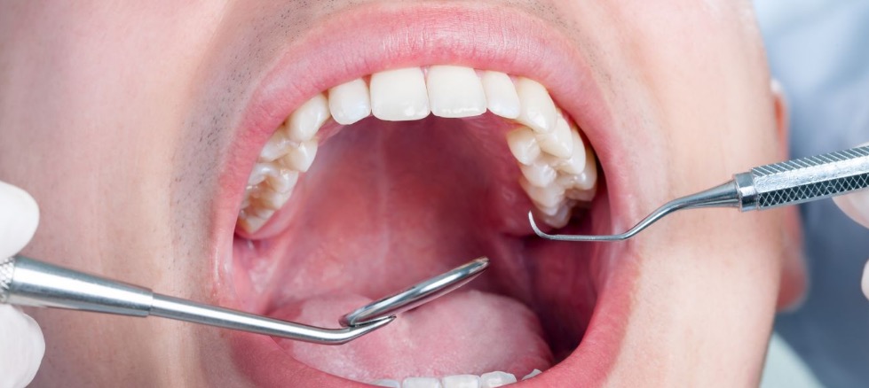 45% das doenças cardíacas começam na boca