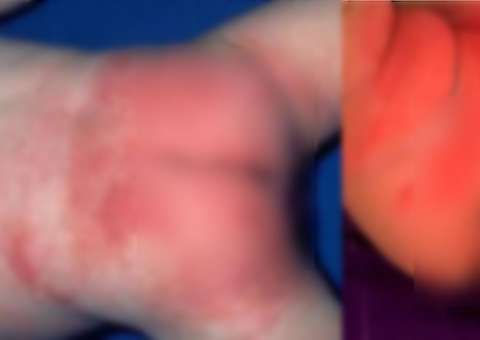 Substâncias tóxicas e cancerígenas são encontradas em fraldas de bebês