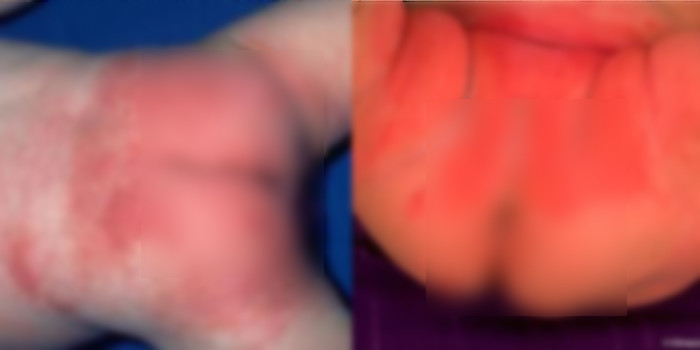 Substâncias tóxicas e cancerígenas são encontradas em fraldas de bebês