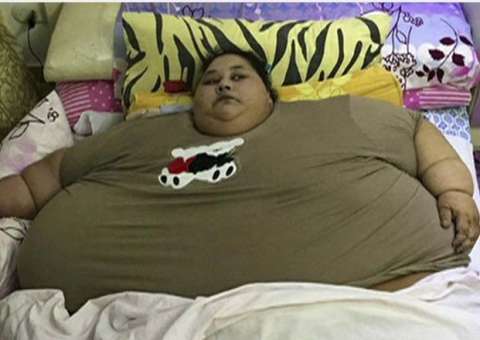  'Mulher mais pesada do mundo', perde 250 kg em dois meses após cirurgia bariátrica