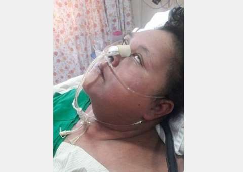 Mulher perde 250kg após cirurgia  e fica sem movimentos 