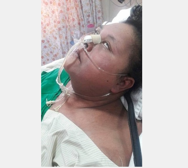 Mulher perde 250kg após cirurgia  e fica sem movimentos 