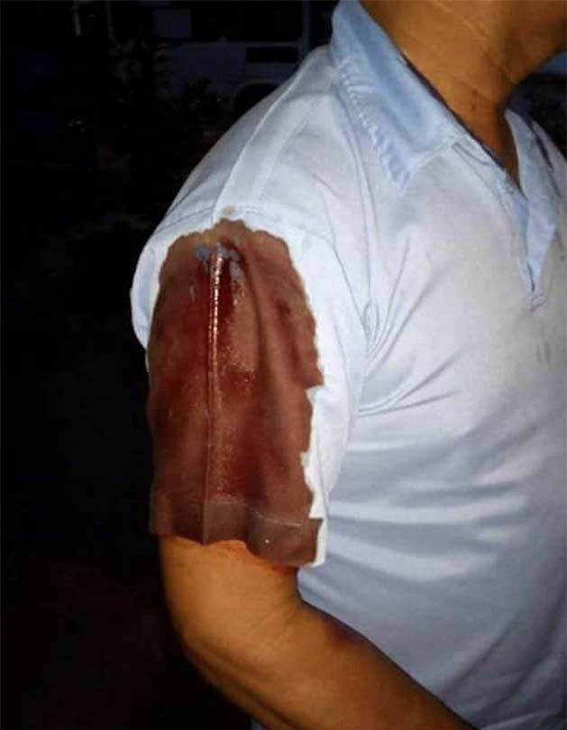  Assalto a ônibus termina com motorista ferido na Zona Leste de Manaus 