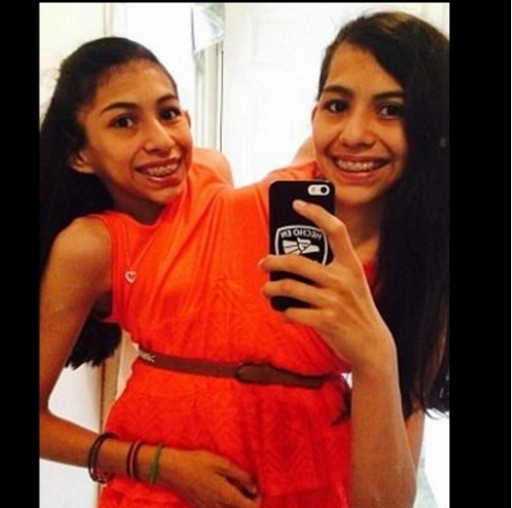 Gêmeas que nasceram unidas se recusam a se separar