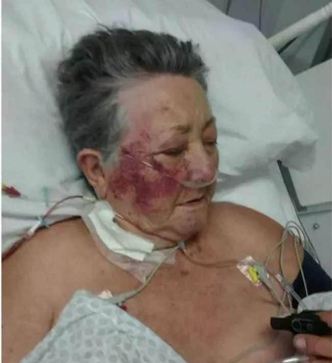 Morre idosa de 78 anos agredida por enfermeiro na UTI 