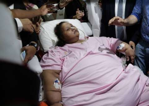 Com 325 quilos a menos, mulher deixa hospital após cirurgia