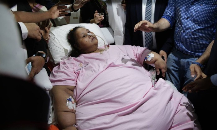 Com 325 quilos a menos, mulher deixa hospital após cirurgia